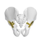 Plat Pelvis Belakang