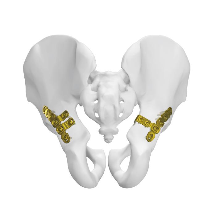 Plat Pelvis Belakang