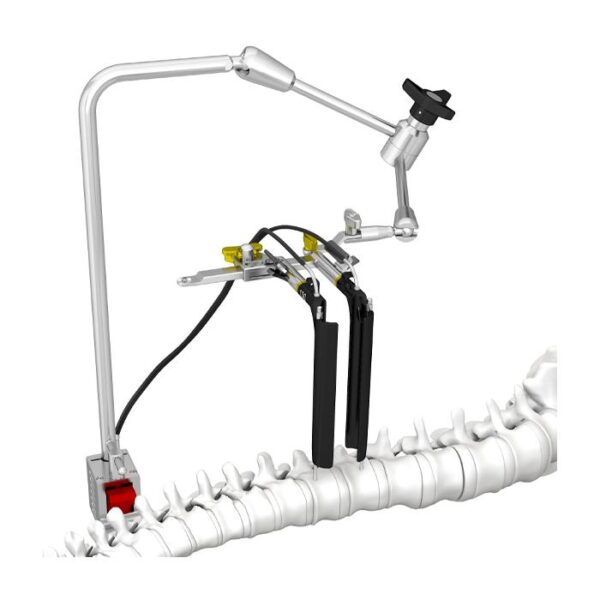 Set Instrumen Sistem Akses Anterolateral Tulang Belakang MIS