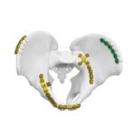 Plat Sendi Sakroiliak Anterior