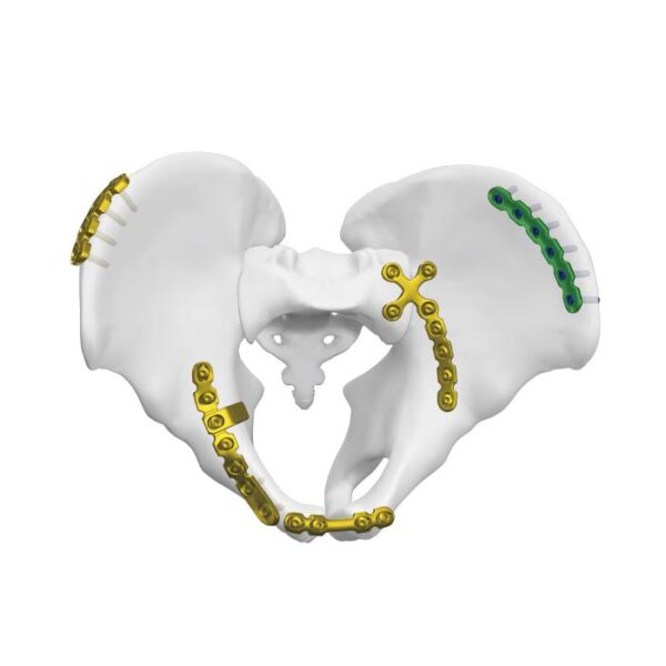 Plat Sendi Sakroiliak Anterior