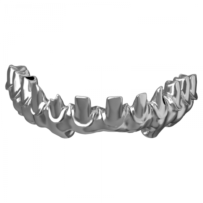 Jambatan Implan Titanium