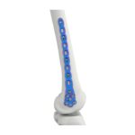 PLAT PENGGANTUNG FEMUR DISTAL