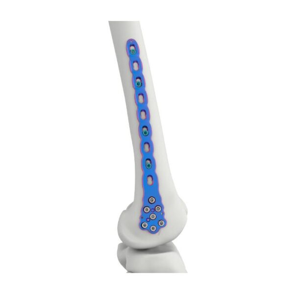 PLAT PENGGANTUNG FEMUR DISTAL