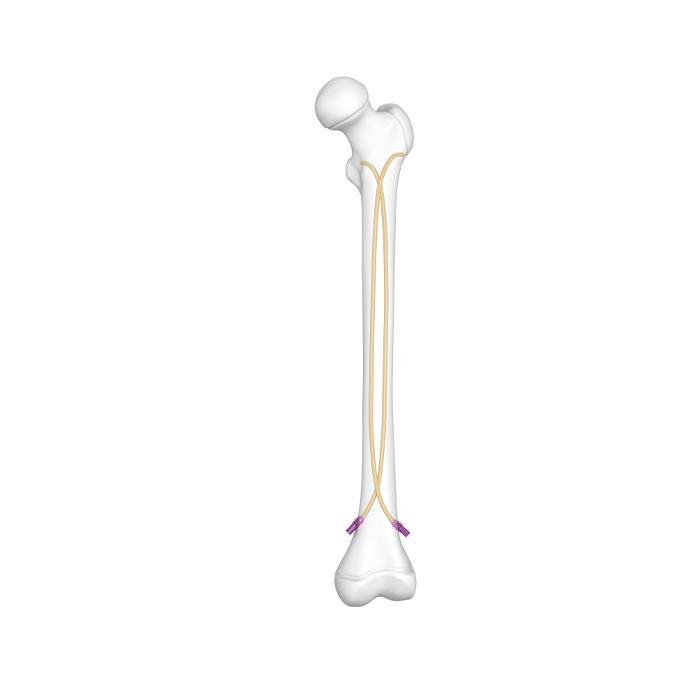 Kuku Elastik Titanium